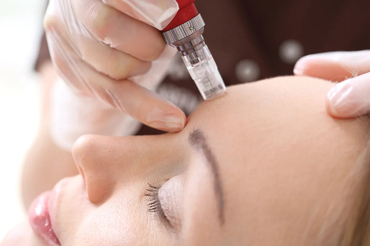 Close-up of a microneedling treatment.